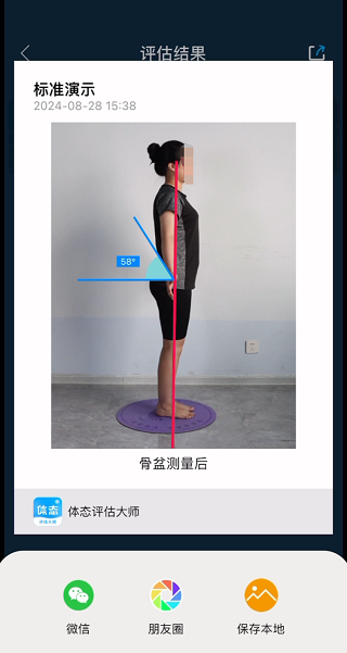 体态评估大师